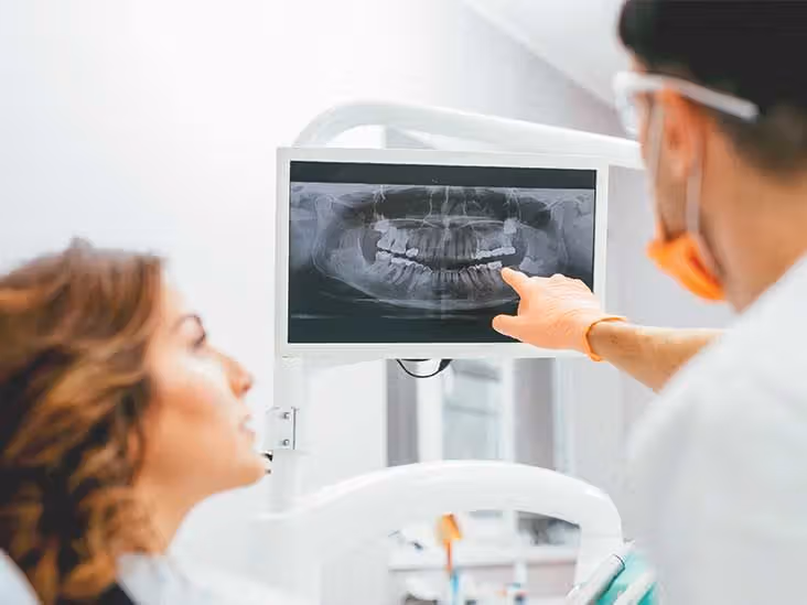 Digital Dental X-Ray Equipment
